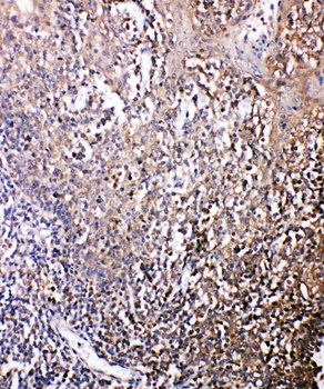 Anti-Bonzo/CXCR6 Antibody