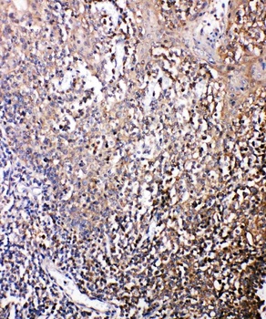 Bonzo/CXCR6 Antibody