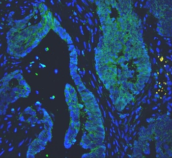 PC1/3/PCSK1 Antibody