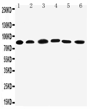 Anti-PC1/3/PCSK1 Antibody