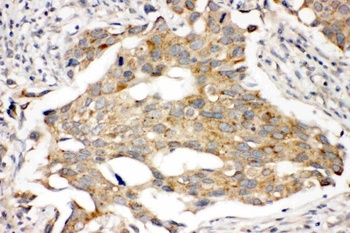 Anti-Prolactin Receptor/PRLR Antibody