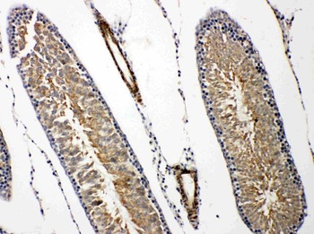 Anti-Prolactin Receptor/PRLR Antibody