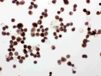 Anti-WISP1 Antibody