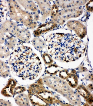 Anti-WISP1 Antibody