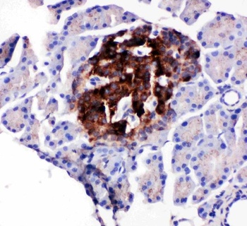 Anti-WISP1 Antibody