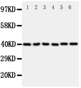 Anti-WISP1 Antibody