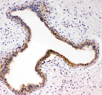 Anti-TrkC/NTRK3 Antibody