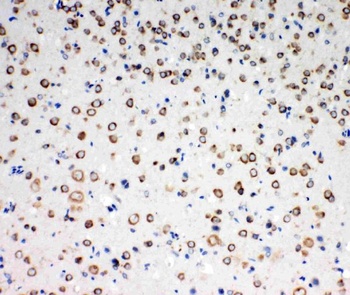 Anti-TrkC/NTRK3 Antibody
