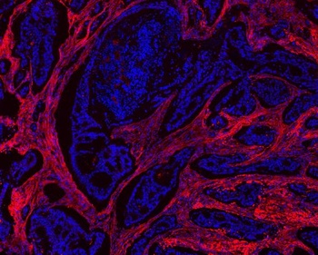 Anti-Collagen I/COL1A1 Antibody