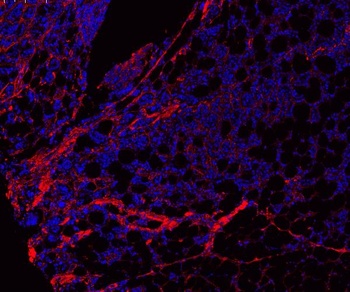 Collagen I/COL1A1 Antibody