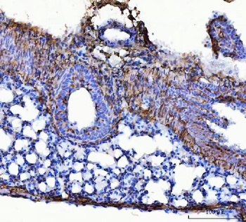 Collagen I/COL1A1 Antibody