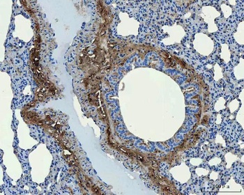 Collagen I/COL1A1 Antibody