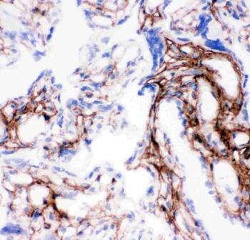 Anti-Collagen I/COL1A1 Antibody
