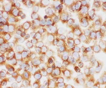 Anti-Collagen I/COL1A1 Antibody