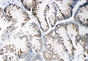 Anti-Matrix metalloproteinase-14 MMP14 Antibody