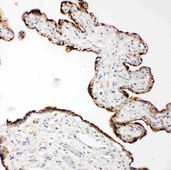 Anti-Matrix metalloproteinase-14 MMP14 Antibody