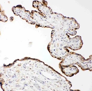 Matrix metalloproteinase-14 MMP14 Antibody