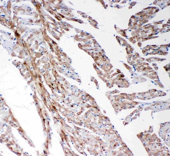 Anti-Matrix metalloproteinase-14 MMP14 Antibody