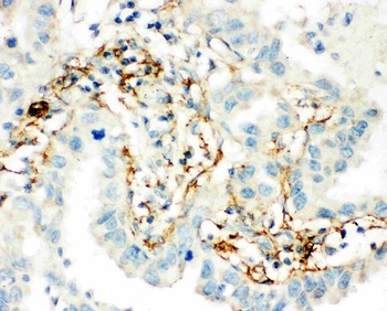 Transglutaminase 2/TGM2 Antibody