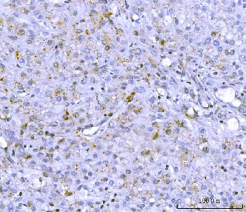 PCSK9 Antibody