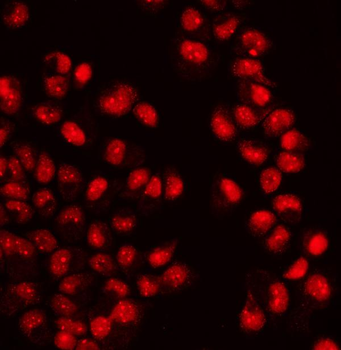 Anti-WAPL/FOE Antibody