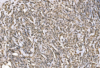 Anti-WAPL/FOE Antibody