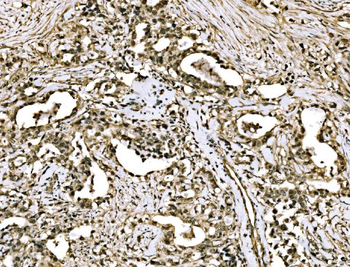 Anti-WAPL/FOE Antibody