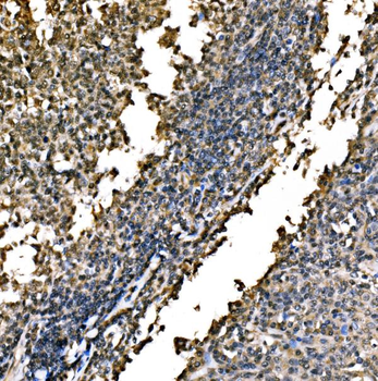Anti-WAPL/FOE Antibody