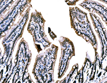 Anti-WAPL/FOE Antibody