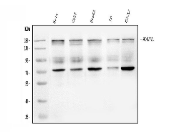 Anti-WAPL/FOE Antibody