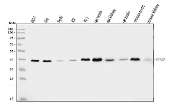 Anti-TSTA3/GFUS Antibody