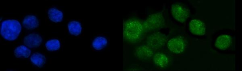 Anti-SP6 Antibody