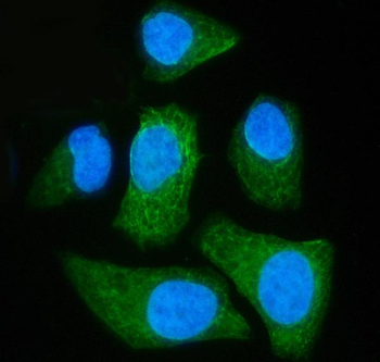 Anti-SLC25A51/52 Antibody