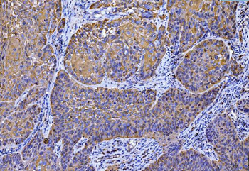 Anti-SLC25A51/52 Antibody