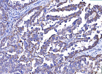 Anti-SLC25A51/52 Antibody