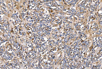 Anti-Alpha 2 Antiplasmin/SERPINF2 Antibody