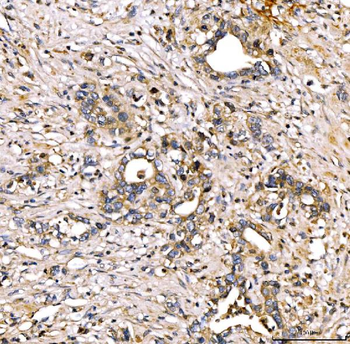 Anti-Alpha 2 Antiplasmin/SERPINF2 Antibody