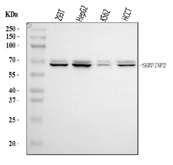 Alpha 2 Antiplasmin/SERPINF2 Antibody