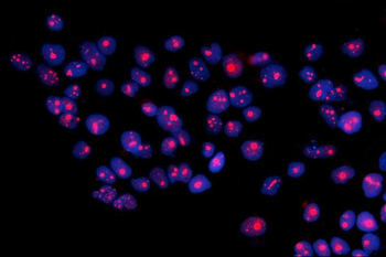 Anti-RRS1 Antibody