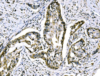 Anti-RRS1 Antibody