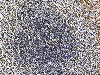 Anti-RRS1 Antibody