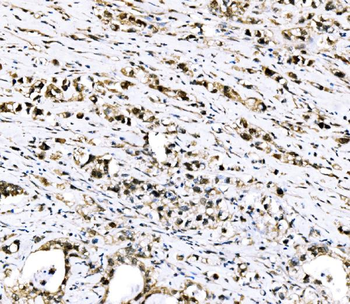 Anti-RRS1 Antibody