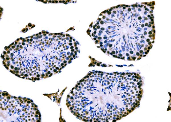 Anti-RRS1 Antibody