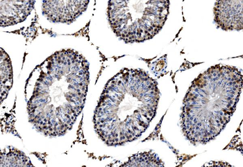 Anti-RRS1 Antibody