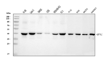 Anti-RRS1 Antibody