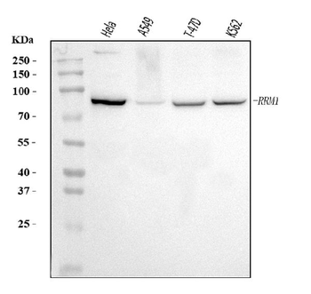 Anti-RRM1 Antibody