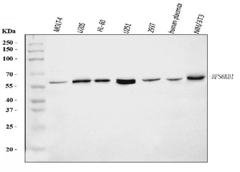 Anti-S6K1/RPS6KB1 Antibody