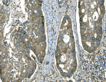 Anti-RAB13 Antibody