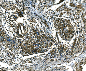 Anti-RAB13 Antibody