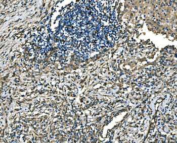 Anti-RAB13 Antibody